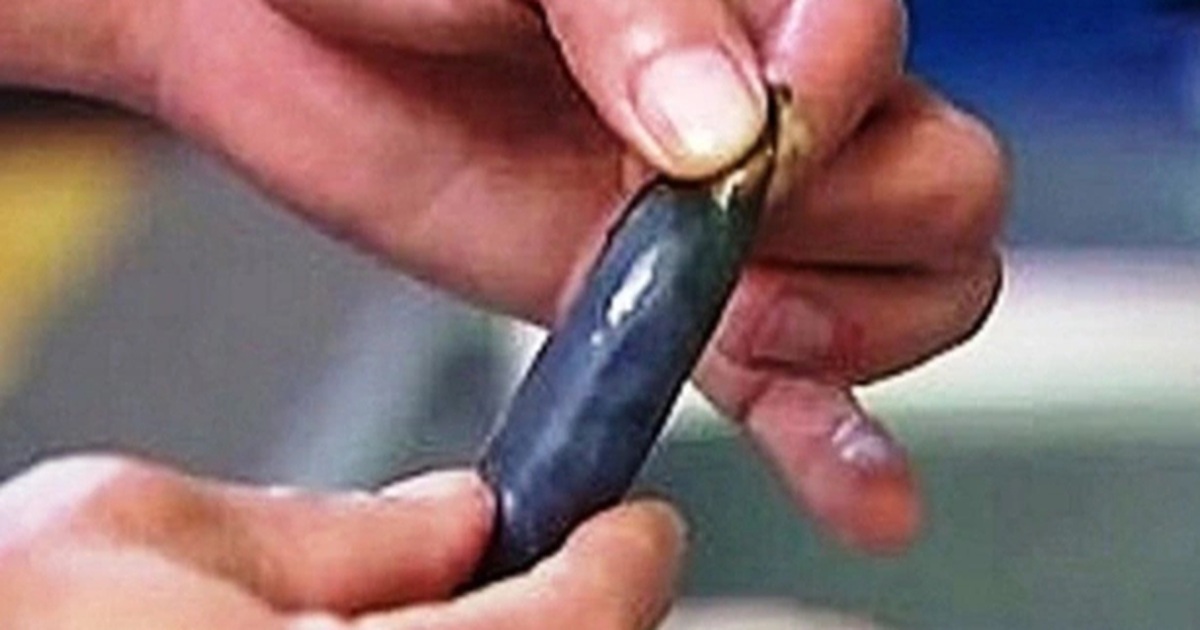 Bé trai 6 tuổi tử vong sau khi dùng mật cá trắm chữa bệnh