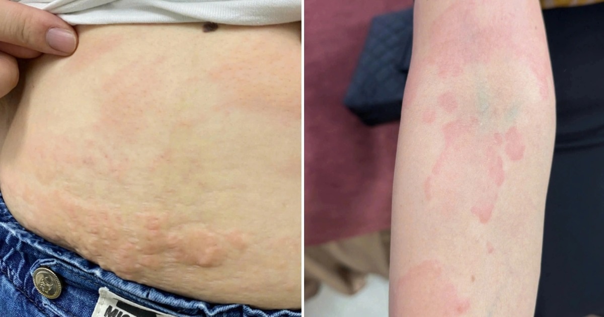 Căn bệnh gia tăng mạnh dịp cuối năm vì mâm tất niên "độc, lạ"