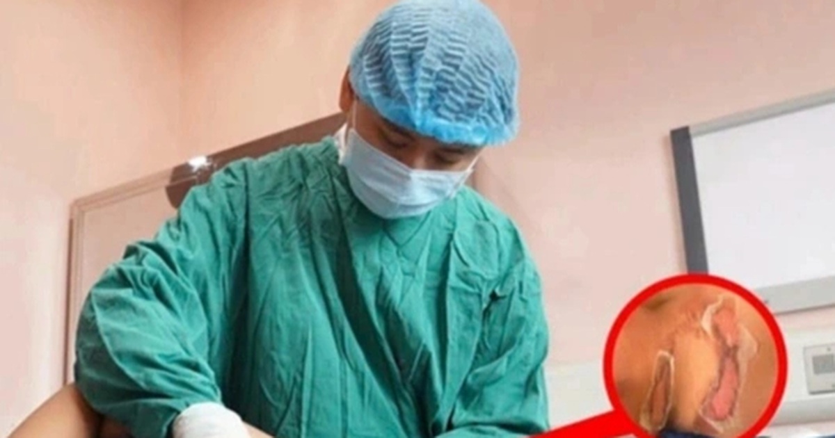 Tắm bằng vòi hoa sen, bé trai ở Hà Nội bỏng khắp người