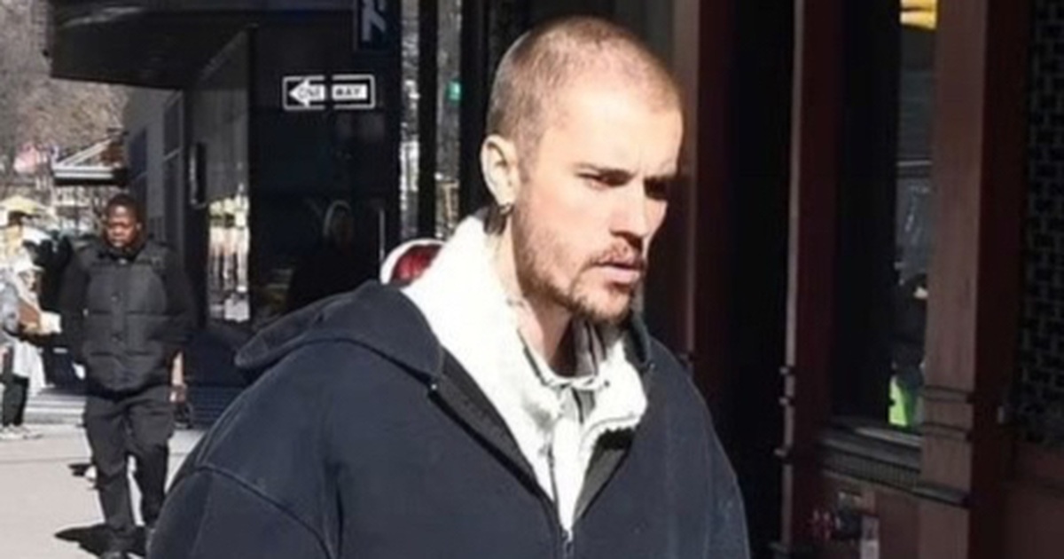 Tình trạng sức khỏe tinh thần của Justin Bieber khiến người hâm mộ lo lắng