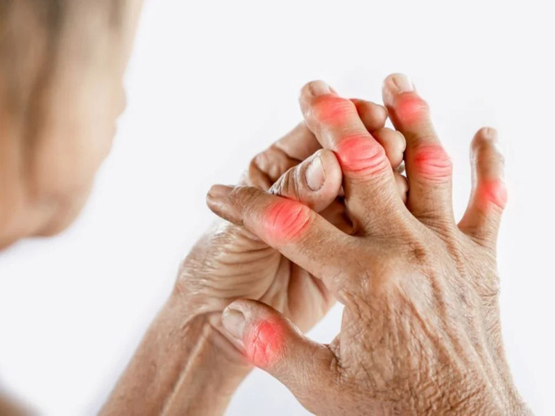 Bài Thuốc Nam Chữa Viêm Xương Khớp: Giải Pháp An Toàn và Hiệu Quả Bệnh viêm xương khớp gây đau nhức và khó khăn trong vận động