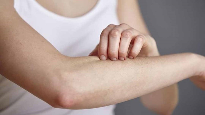 Thuốc Nam Trị Ngứa Toàn Thân: 15 Loại Thảo Dược Hiệu Quả Thuốc Nam trị ngứa toàn thân từ các loại thảo dược tự nhiên
