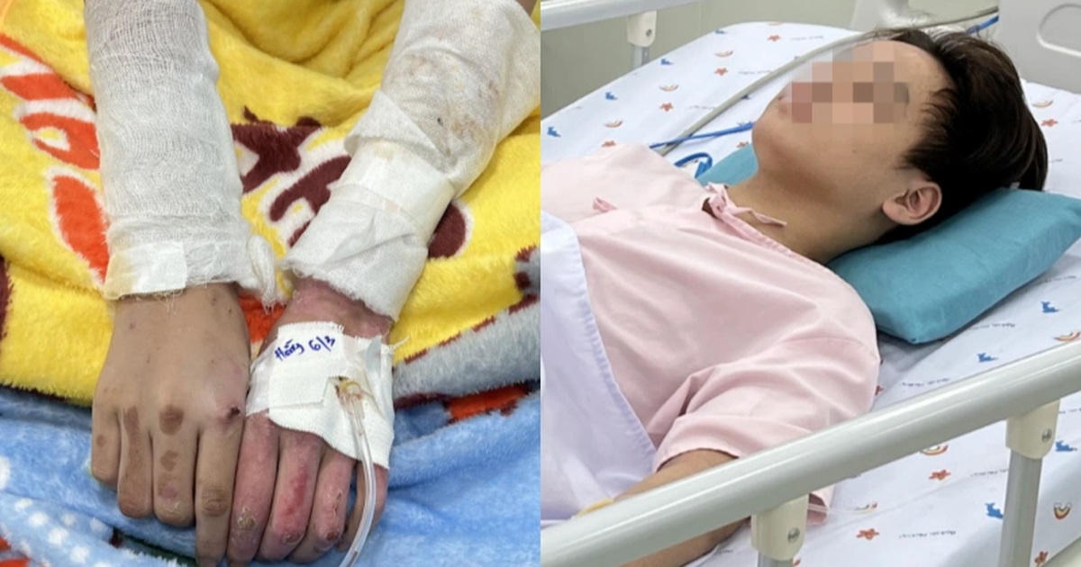 Cập Nhật Tình Hình Sức Khỏe Các Nạn Nhân Vụ Cháy Tiệm Bánh Kem Tại TP.HCM Bé gái "đen kịt" khi vào viện, cha mẹ cũng bỏng nặng trong vụ cháy ở TPHCM