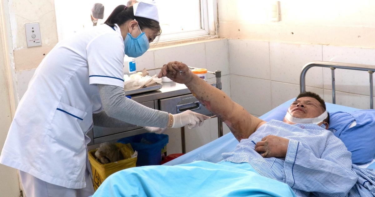 Vụ Nổ Tại Công Ty SGI Vina: 12 Công Nhân Bị Ảnh Hưởng, Nguyên Nhân Chưa Được Xác Định Chưa xác định được nguyên nhân vụ nổ tại Công ty SGI Vina