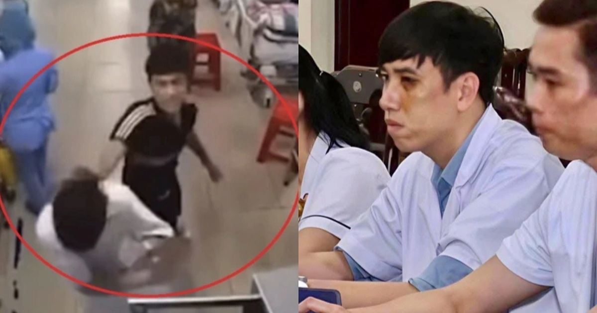 Đau lòng bức ảnh điều dưỡng sưng mắt vì bị đánh trước ngày tôn vinh nghề Đau lòng bức ảnh điều dưỡng sưng mắt vì bị đánh trước ngày tôn vinh nghề