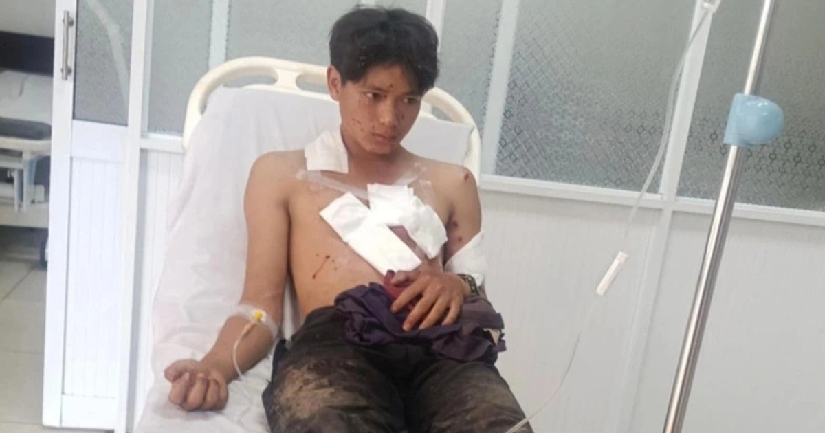 Nổ mìn tự chế khi đi đánh cá, hai thanh niên bị thương nặng tại Gia Lai Nổ mìn tự chế khi đi đánh cá, 2 thanh niên bị thương nặng