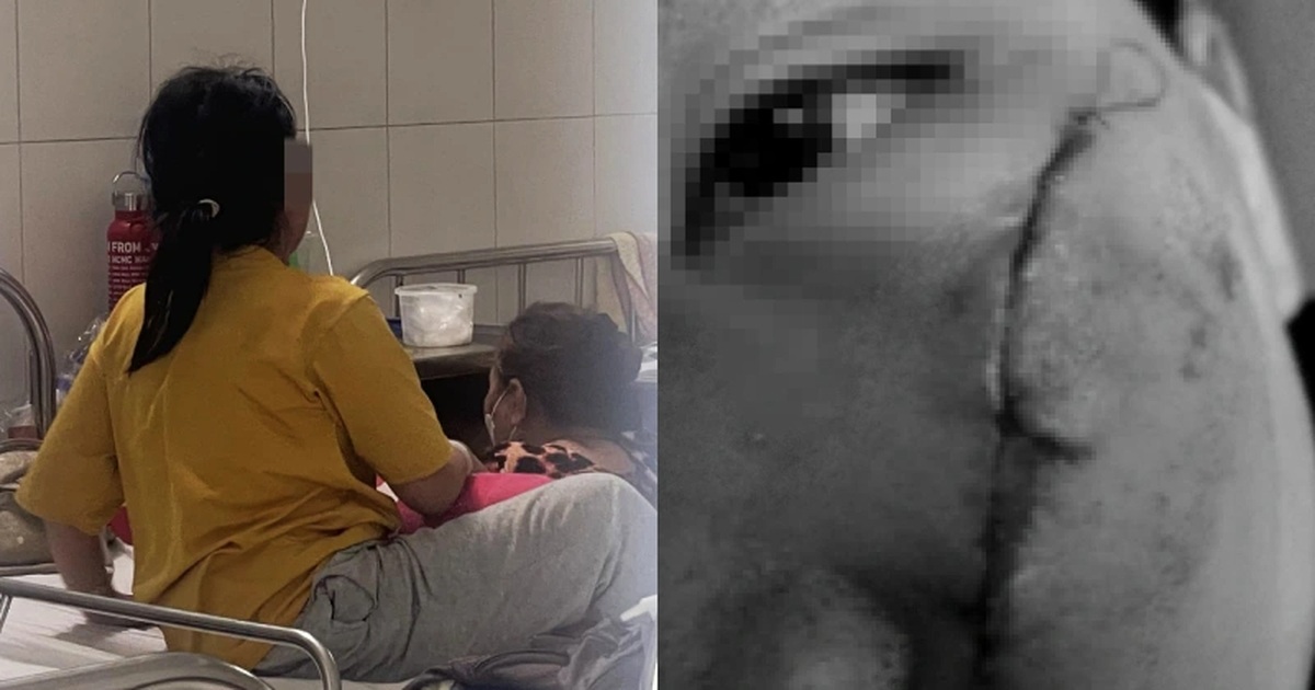 Tình Hình Sức Khỏe Bé Gái Bị Đánh Bằng Xẻng Tại Mái Ấm Thiên Thần Ở TPHCM Bé gái co giật sau khi bị đánh bằng xẻng tại mái ấm ở TPHCM hiện ra sao?