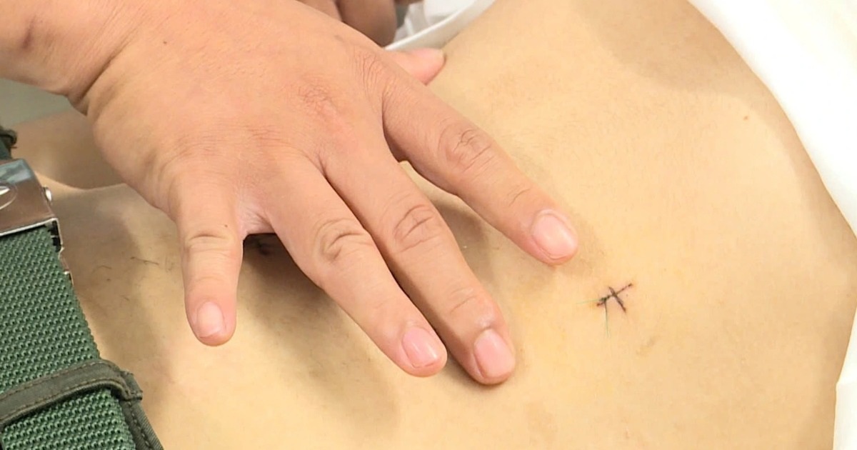 Chàng trai 19 tuổi loét ruột nguy kịch sau thời gian dài nghiện điện thoại Chàng trai 19 tuổi loét ruột nguy kịch sau thời gian dài nghiện điện thoại