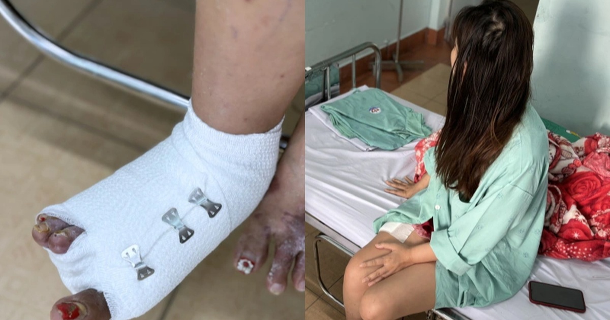 Cô gái ở TPHCM hoại tử khi ngâm nước nóng, đi 4 bệnh viện vẫn mất ngón chân Cô gái ở TPHCM hoại tử khi ngâm nước nóng, đi 4 bệnh viện vẫn mất ngón chân