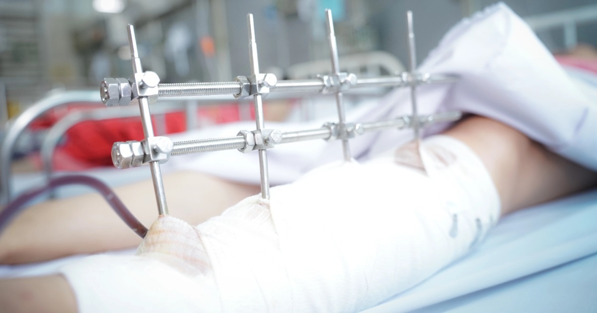 Cứu sống ngoạn mục người phụ nữ nguy kịch vì tường đổ trong mưa Cứu sống ngoạn mục người phụ nữ nguy kịch vì tường đổ trong mưa