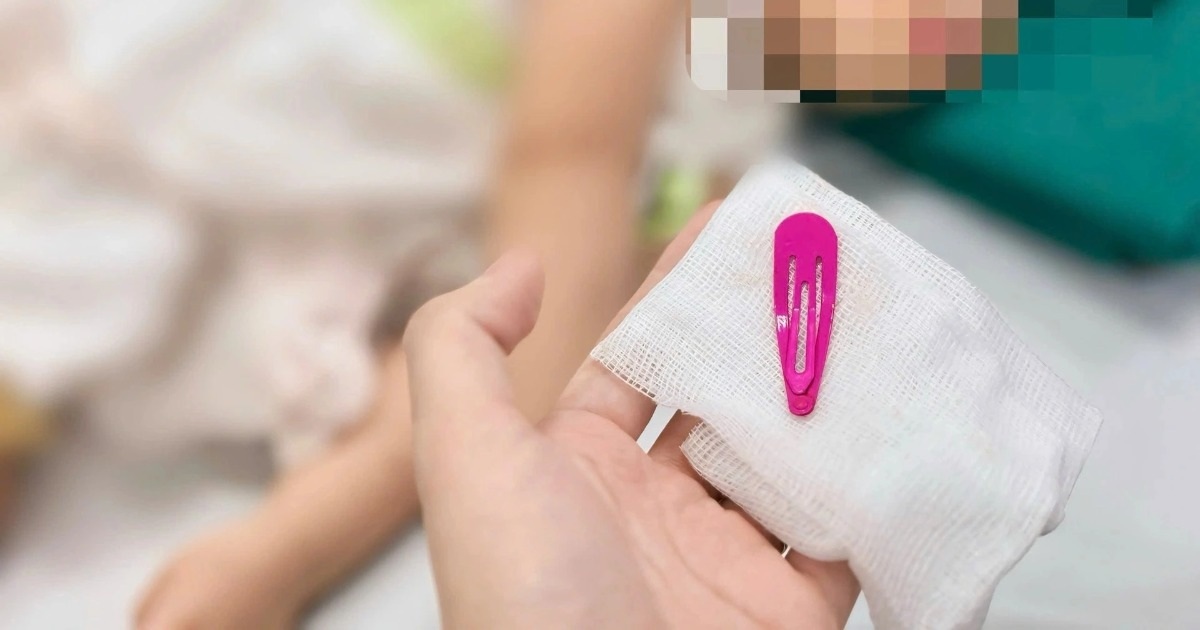 Hà Nội: Bé gái 21 tháng tuổi nuốt kẹp tóc vào bụng Hà Nội: Bé gái 21 tháng tuổi nuốt kẹp tóc vào bụng