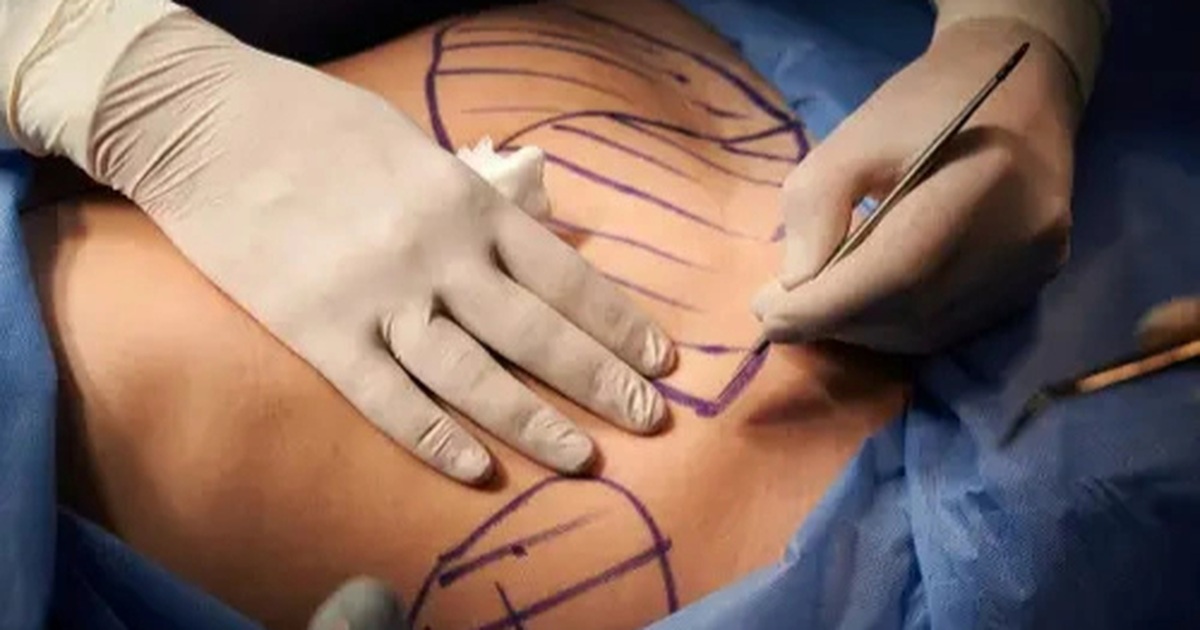 Nam giới chi hàng chục nghìn USD “dao kéo” để có cơ bụng 6 múi Nam giới chi hàng chục nghìn USD "dao kéo" để có cơ bụng 6 múi
