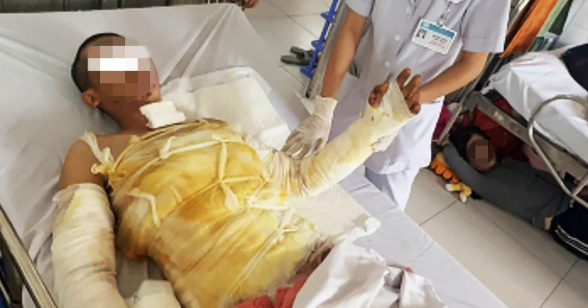 Sửa đèn bảng hiệu, người đàn ông 32 tuổi bị điện phóng vào người bỏng 41% Sửa đèn bảng hiệu, người đàn ông 32 tuổi bị điện phóng vào người bỏng 41%