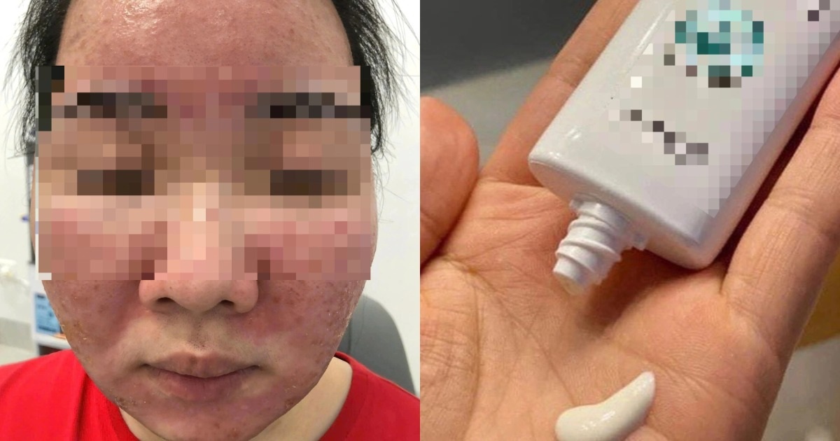 Tin kem chống nắng nổ trên mạng xã hội, mặt nữ sinh “nở hoa” Tin kem chống nắng nổ trên mạng xã hội, mặt nữ sinh "nở hoa"