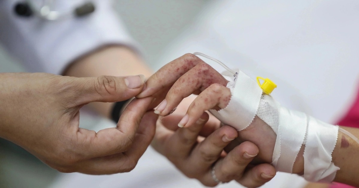Căn bệnh khiến bác sĩ “đi làm 20 năm vẫn sợ nhất” Căn bệnh khiến bác sĩ "đi làm 20 năm vẫn sợ nhất"