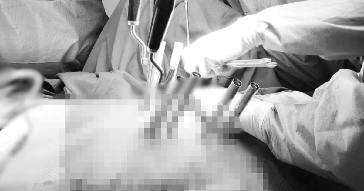 Thang máy đứt cáp rơi thẳng xuống đất, một phụ nữ gãy cột sống nặng nề Thang máy đứt cáp rơi thẳng xuống đất, một phụ nữ gãy cột sống nặng nề
