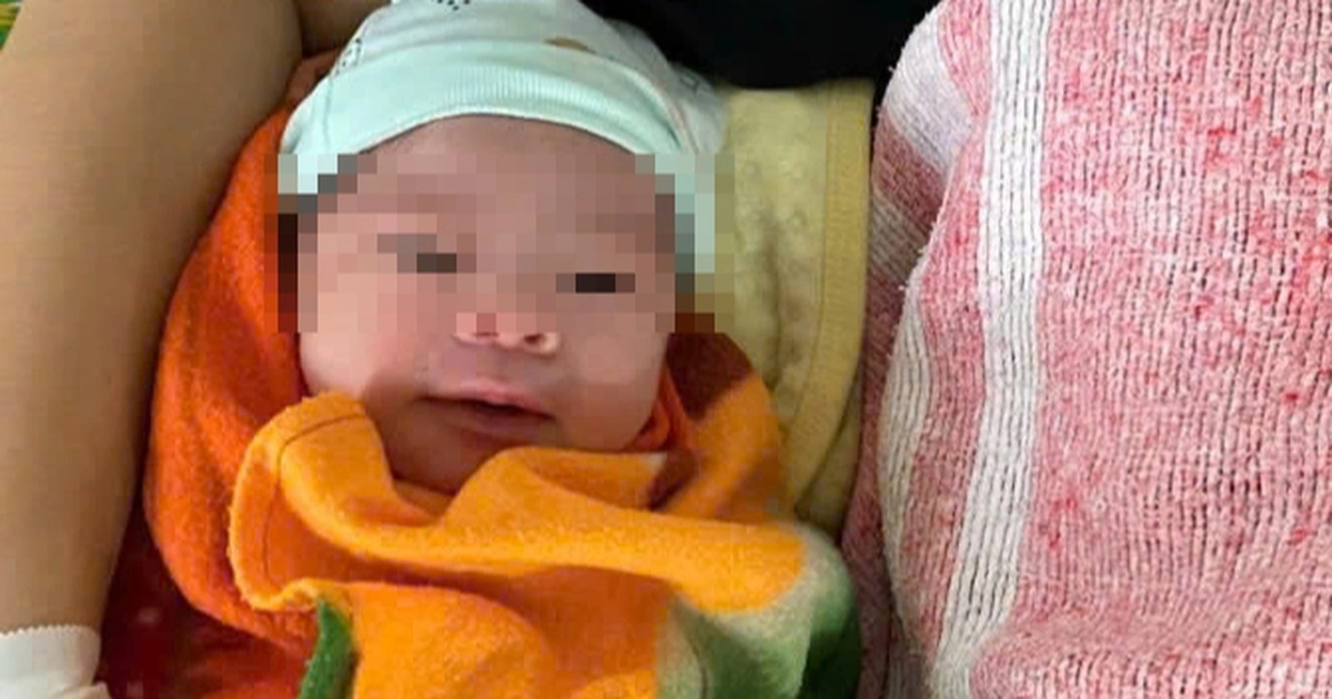Hy hữu, bé trai sơ sinh chào đời với dây rốn quấn 6 vòng quanh cổ Hy hữu, bé trai sơ sinh chào đời với dây rốn quấn 6 vòng quanh cổ