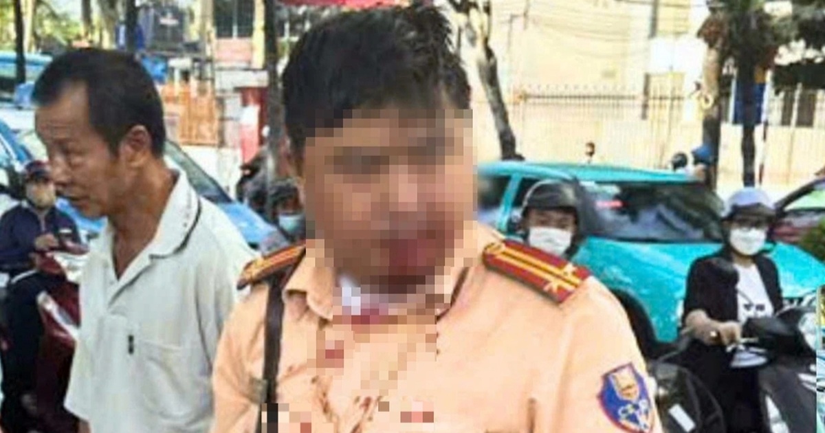 Trung tá CSGT bị người nước ngoài đấm vào mặt khi đang làm nhiệm vụ Trung tá CSGT bị người nước ngoài đấm vào mặt khi đang làm nhiệm vụ