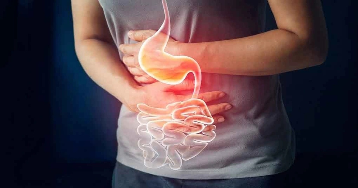 “1 đen, 1 tanh, 2 giảm” cảnh báo ung thư dạ dày “1 đen, 1 tanh, 2 giảm” cảnh báo ung thư dạ dày