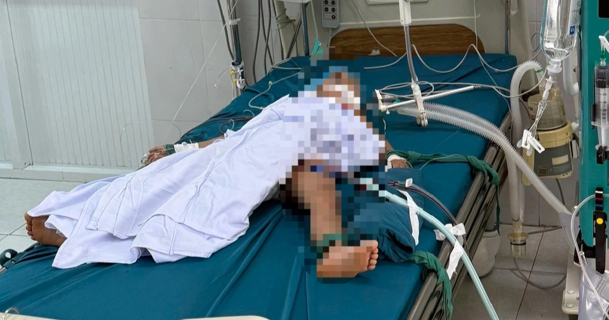 Ba em nhỏ bị ong vò vẽ tấn công, một nạn nhân 5 tuổi tử vong Ba em nhỏ bị ong vò vẽ tấn công, một nạn nhân 5 tuổi tử vong