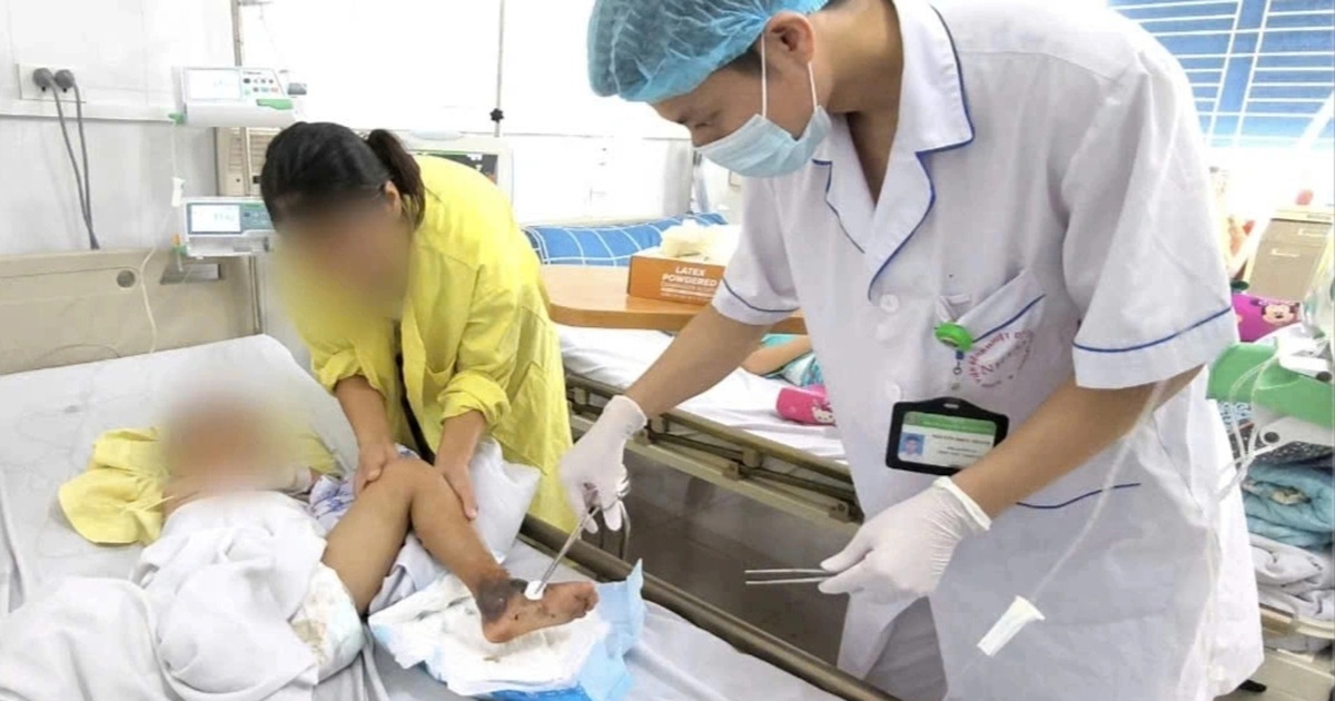 Bé trai hoại tử chân, suy hô hấp vì bị mèo cắn Bé trai hoại tử chân, suy hô hấp vì bị mèo cắn