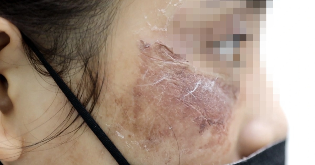 Hiểm họa vì thói quen mua mỹ phẩm, kem bôi da theo “trend” trên mạng Hiểm họa vì thói quen mua mỹ phẩm, kem bôi da theo "trend" trên mạng