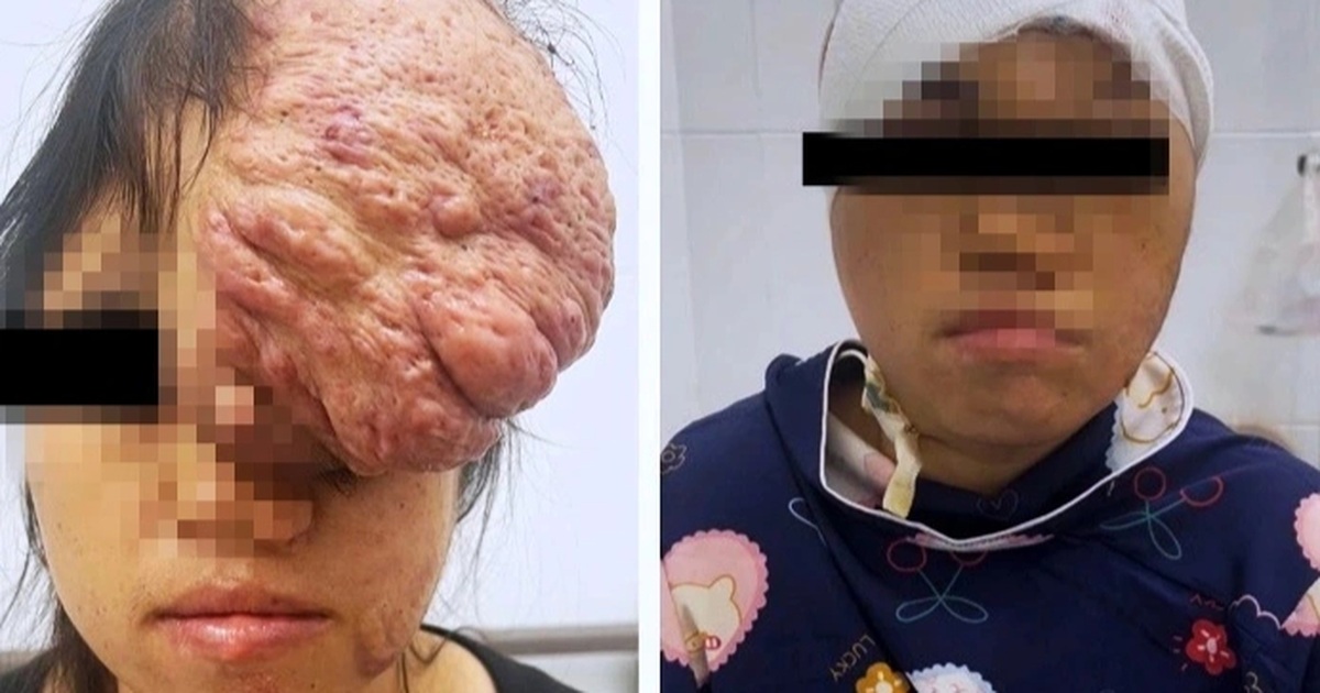 TPHCM: Khẩn cứu 2 phụ nữ mang khối u quái ác ở ruột, xương sọ TPHCM: Khẩn cứu 2 phụ nữ mang khối u quái ác ở ruột, xương sọ