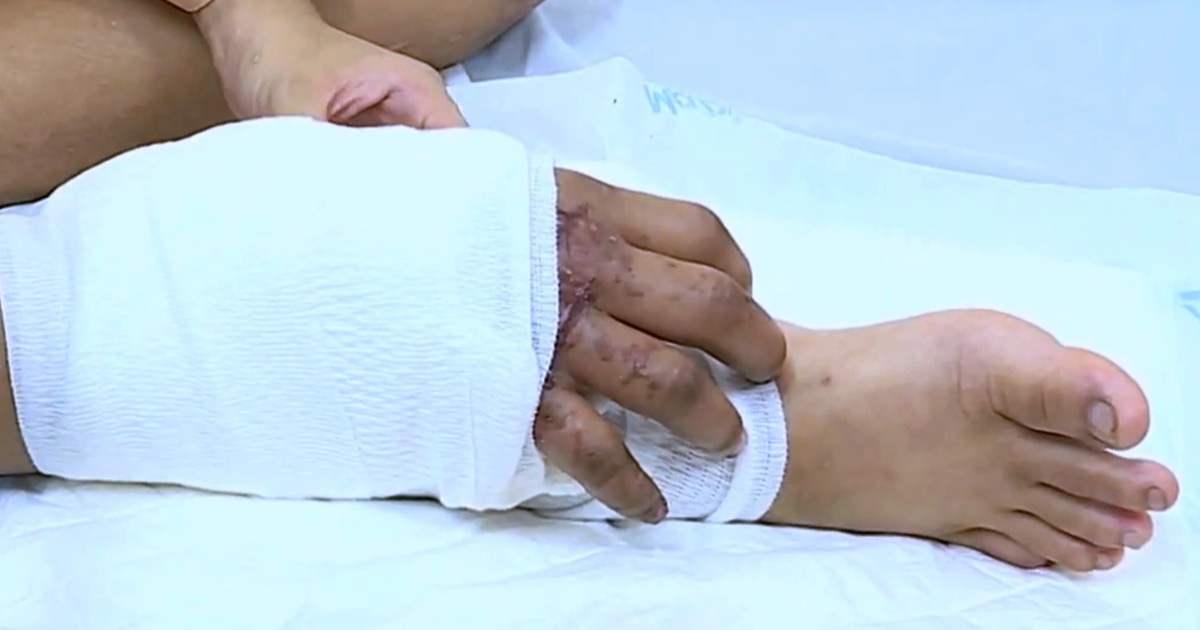 Thông tin mới nhất về cô gái mang thai được ghép tạm tay đứt lìa vào chân Thông tin mới nhất về cô gái mang thai được ghép tạm tay đứt lìa vào chân