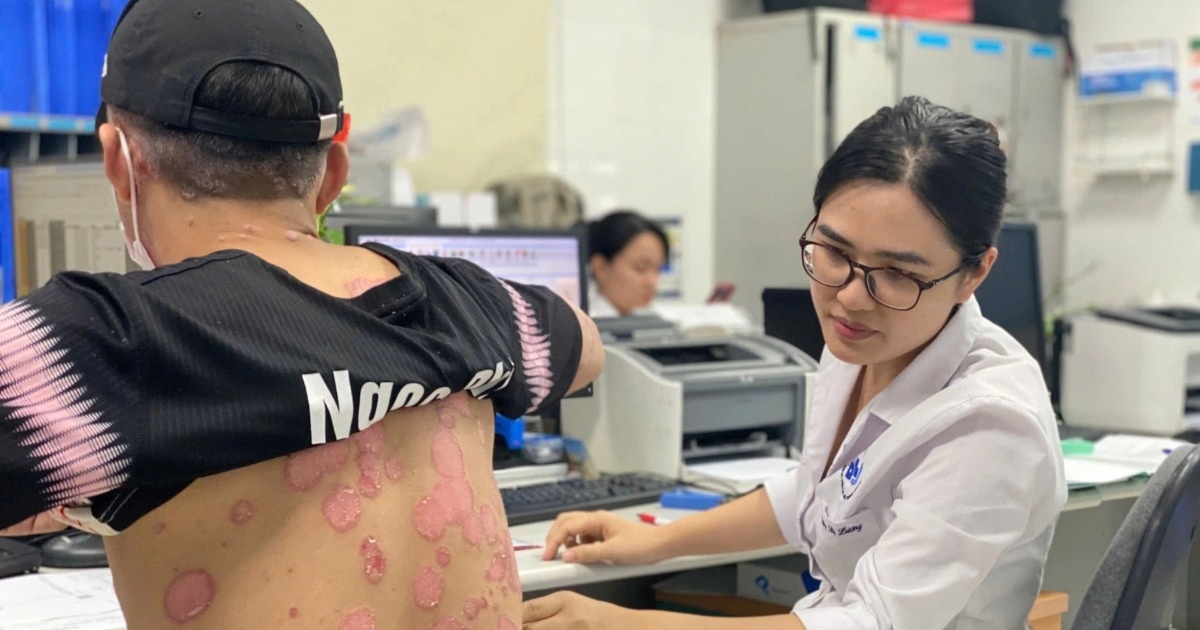 2 triệu người Việt mắc căn bệnh bong tróc da toàn thân