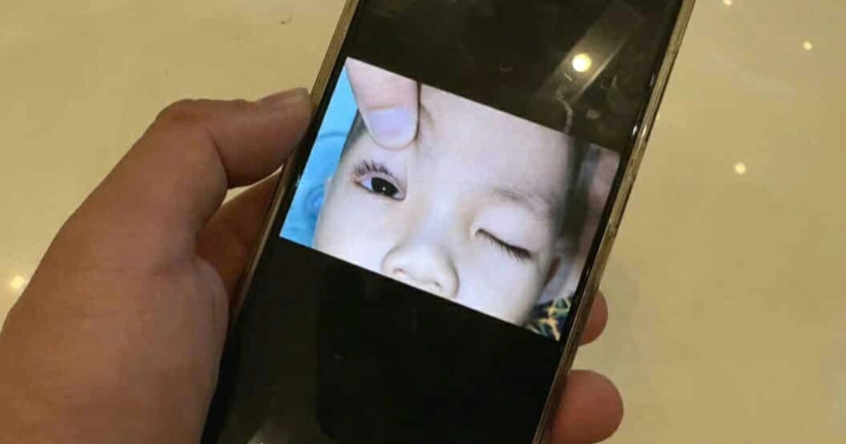 Bé 2 tuổi bị pháo hoa bắn trúng mắt khi xem Trung thu Bé 2 tuổi bị pháo hoa bắn trúng mắt khi xem Trung thu