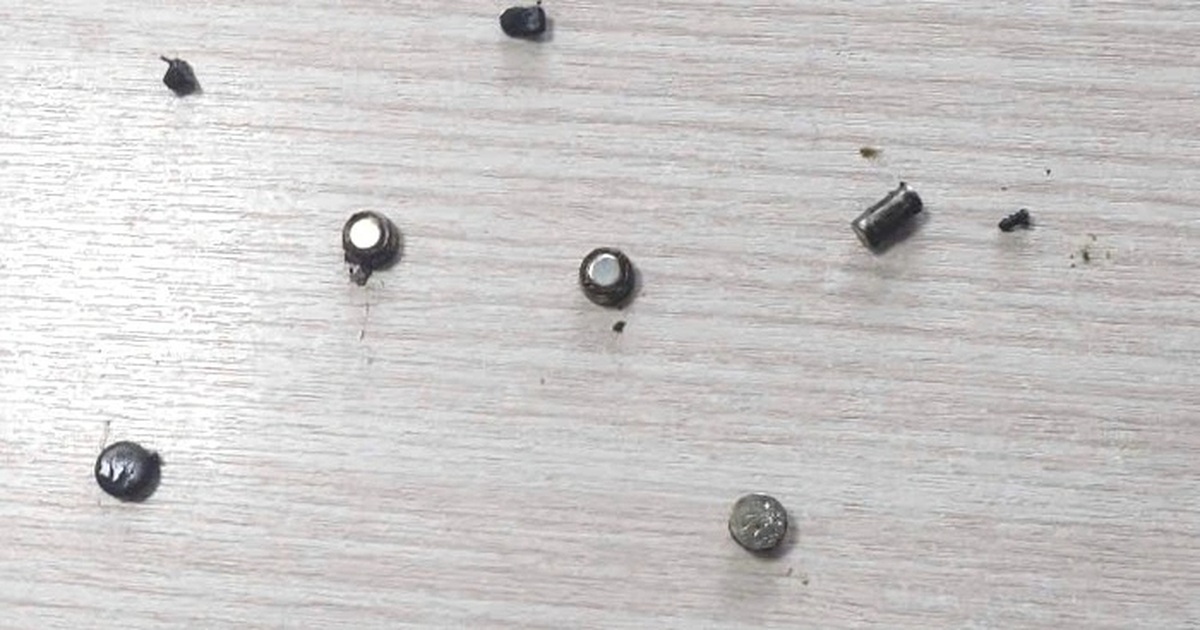 Bé trai 4 tuổi bị thủng ruột vì nuốt 10 cục pin và nam châm Bé trai 4 tuổi bị thủng ruột vì nuốt 10 cục pin và nam châm