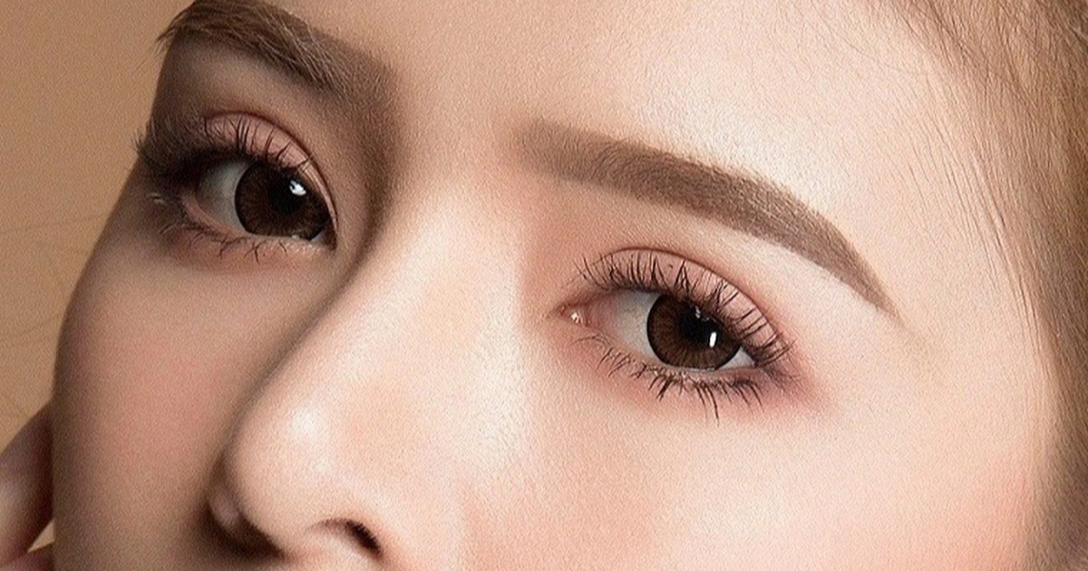 Cắt mí 5 ngày không nhắm được mắt, bác sĩ cảnh báo nguy cơ Cắt mí 5 ngày không nhắm được mắt, bác sĩ cảnh báo nguy cơ