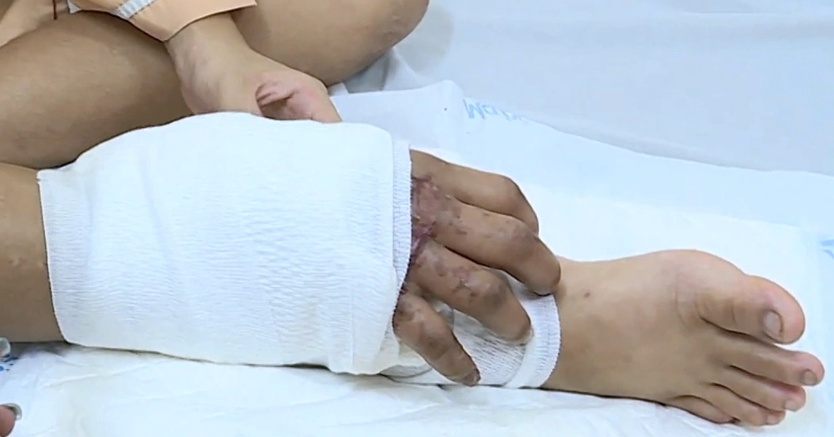 Khi nào mổ tiếp cho cô gái mang thai được ghép tạm tay đứt lìa vào chân? Khi nào mổ tiếp cho cô gái mang thai được ghép tạm tay đứt lìa vào chân?