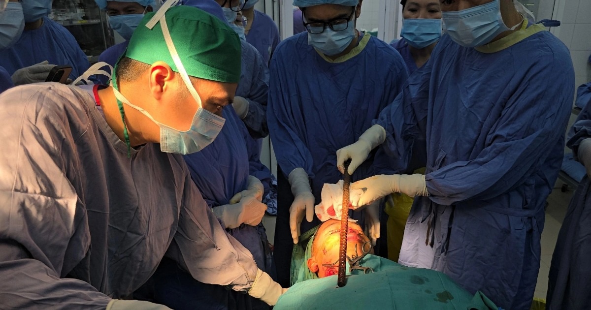 Nam sinh 16 tuổi bị thanh sắt dài 3m đâm xuyên từ đầu qua gáy Nam sinh 16 tuổi bị thanh sắt dài 3m đâm xuyên từ đầu qua gáy
