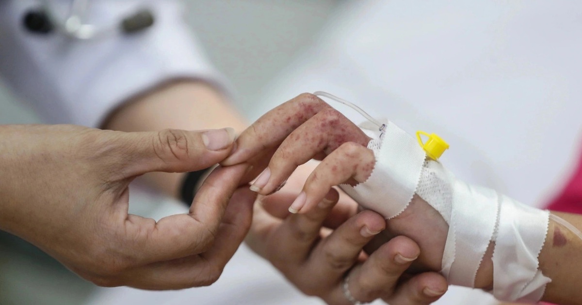Nguy cơ dịch chồng dịch, một bệnh viện ở TPHCM sẵn sàng mở rộng giường bệnh Nguy cơ dịch chồng dịch, một bệnh viện ở TPHCM sẵn sàng mở rộng giường bệnh