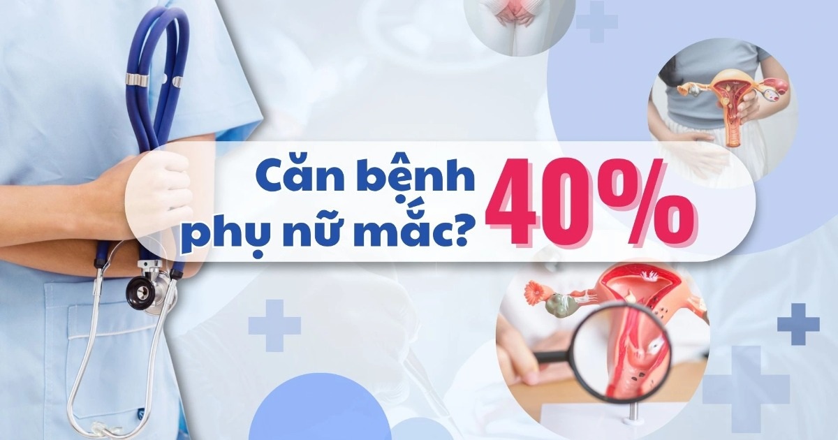 Nhận diện nhóm có nguy cơ cao mắc u xơ tử cung Nhận diện nhóm có nguy cơ cao mắc u xơ tử cung