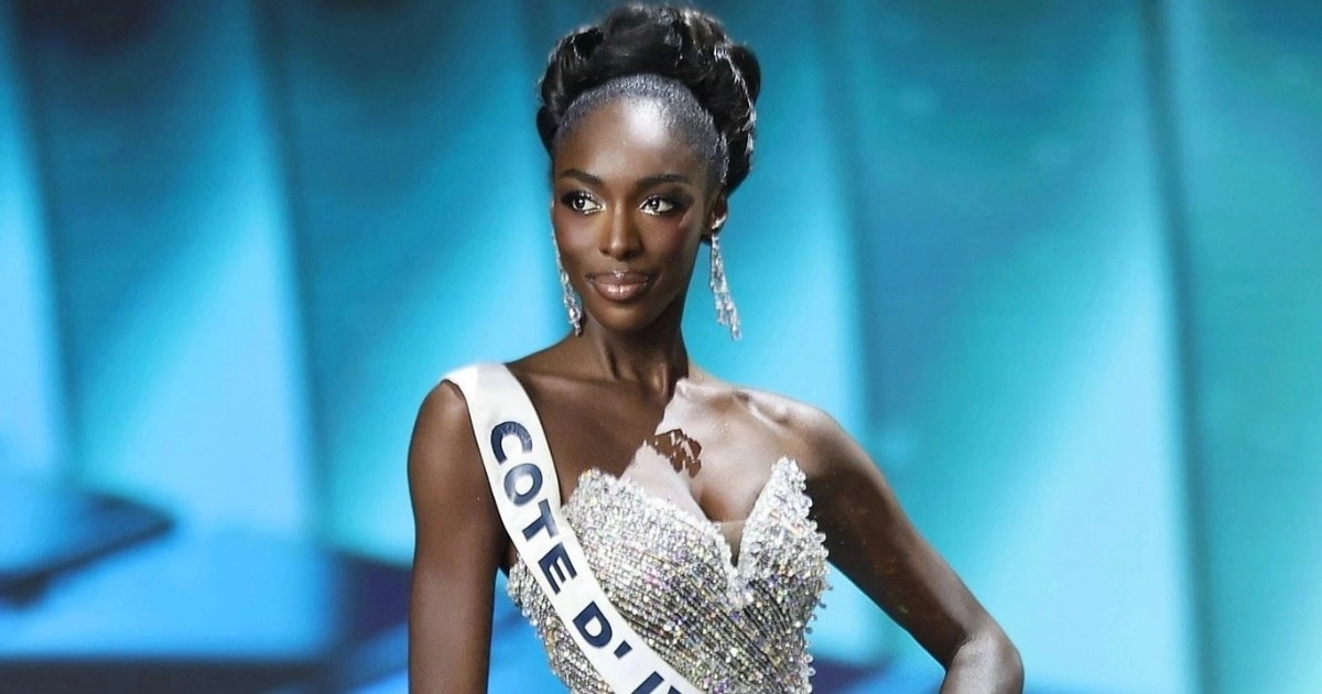 Á hậu của Hoa hậu Hoàn vũ 2025 tuyên bố từ bỏ danh hiệu giữa bão tố dư luận