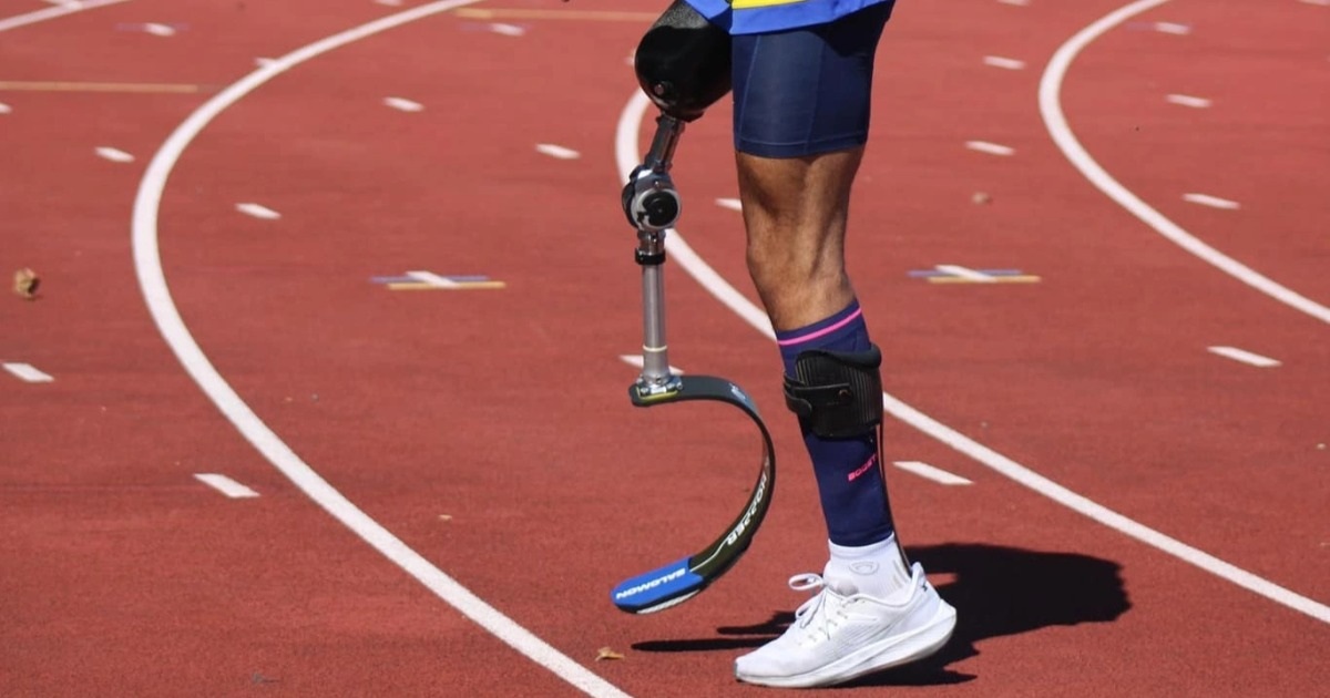 Cầu thủ bóng đá phải cắt chân vì căn bệnh hiểm dễ gây tử vong trong 24 giờ