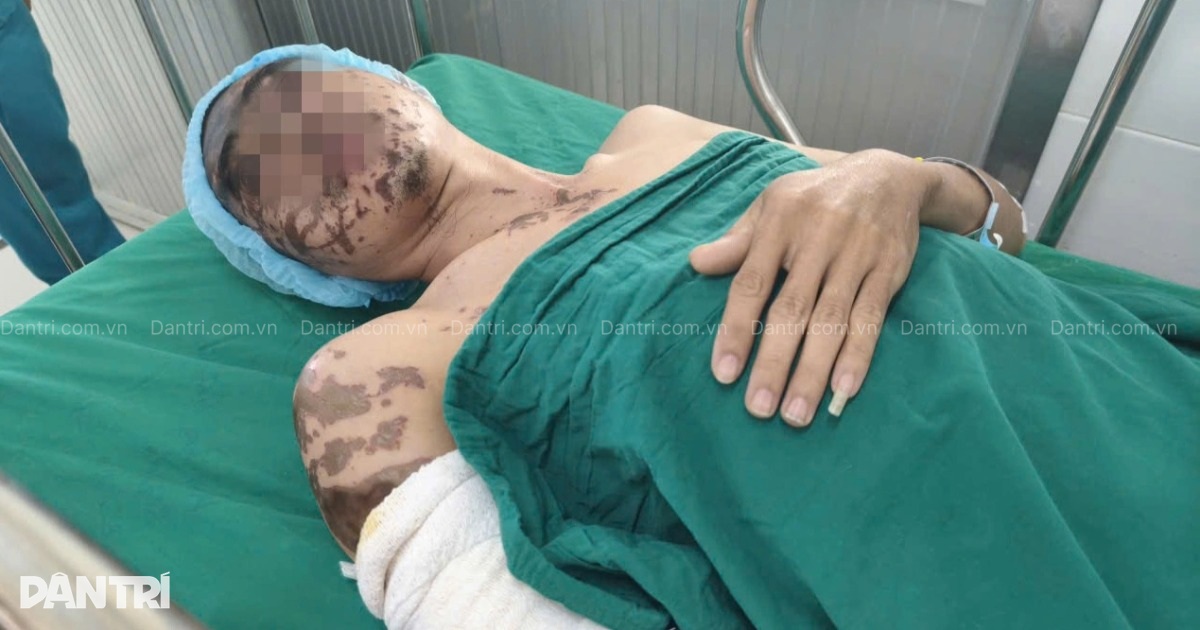 TPHCM: Axit thông cống bắn lên 2 mắt và tay, người đàn ông hoại tử nặng nề