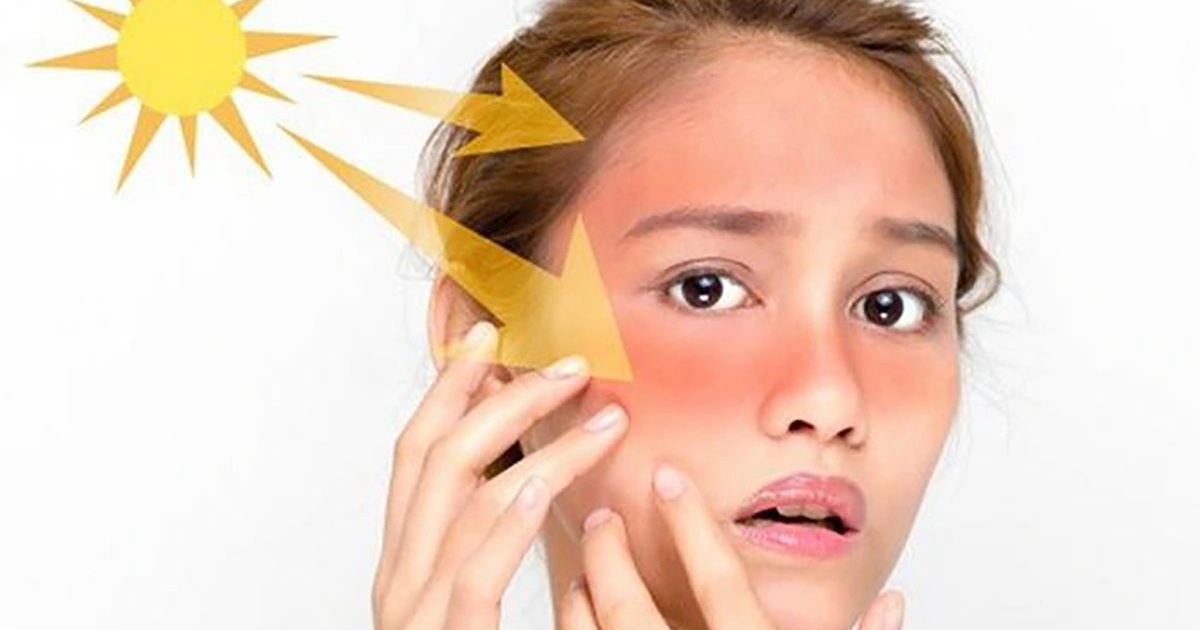 Thu hồi kem chống nắng kém chất lượng, chỉ số chống nắng "có như không"