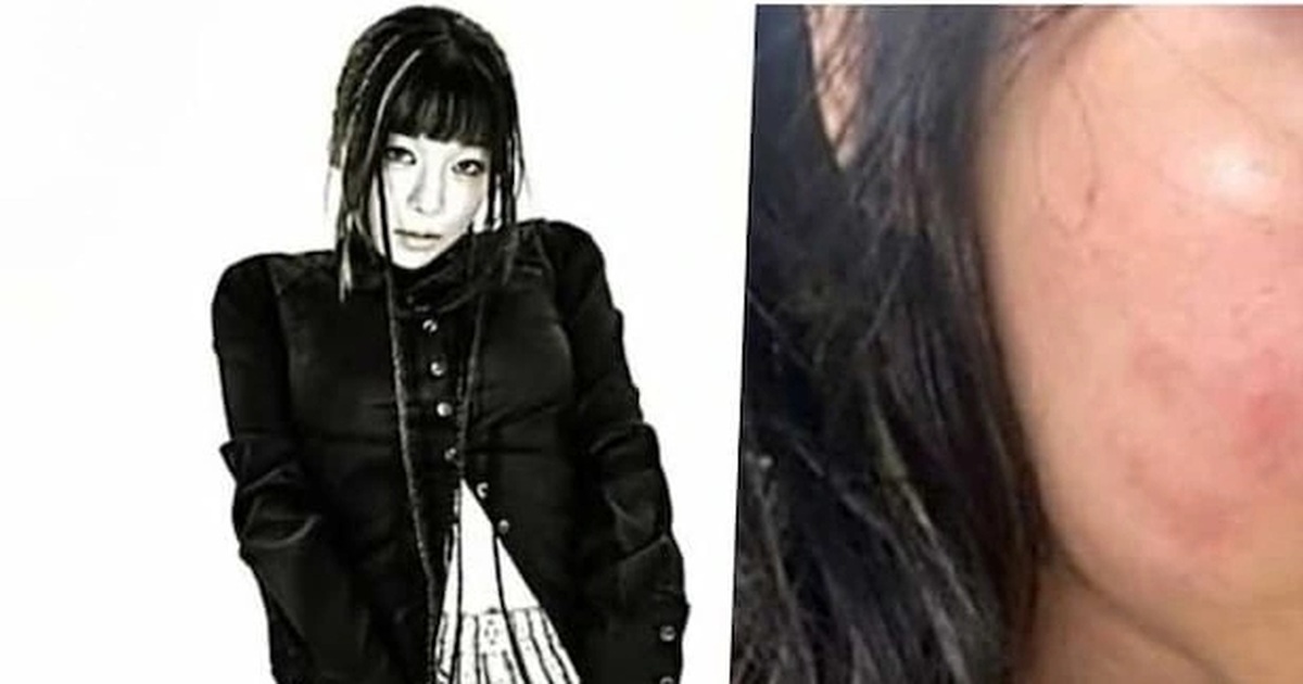 Nữ ca sĩ đau đớn tố bạn trai giam giữ, bạo hành nhưng không thể chia tay